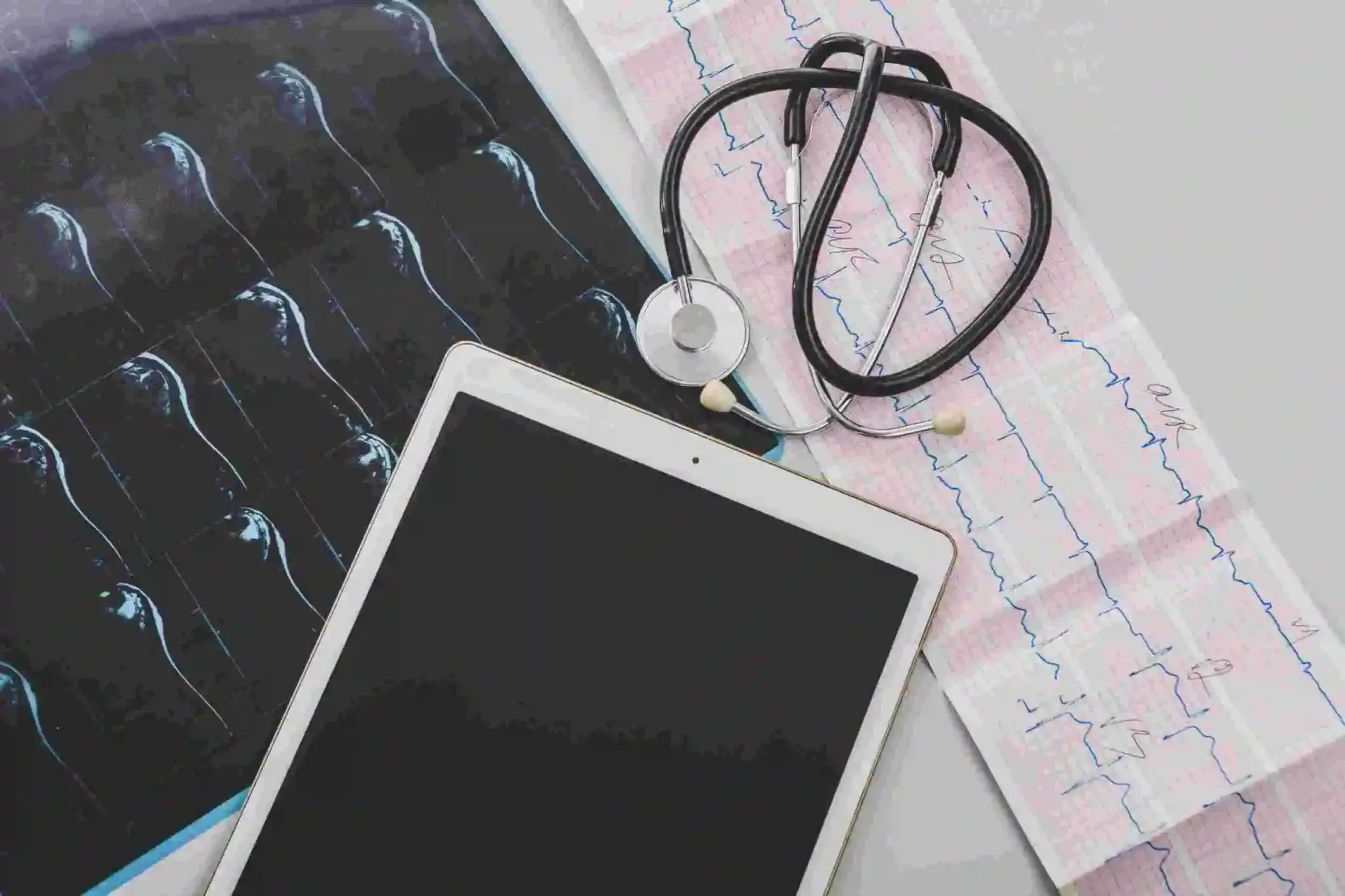 ECG (Electrocardiogram) - Heart Rhythm and Electrical Activity Analysis