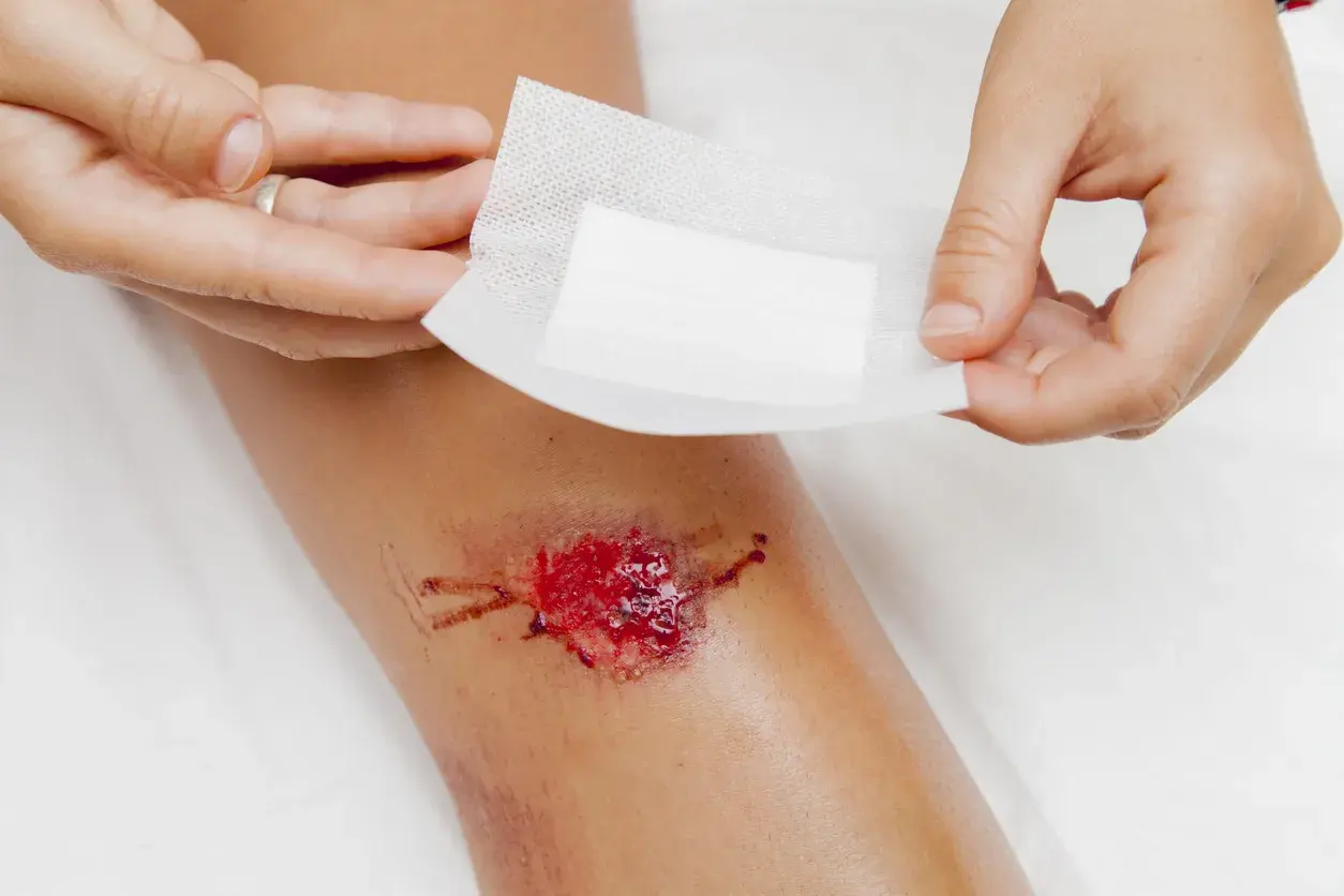 A dressing being applied to a grazed knee