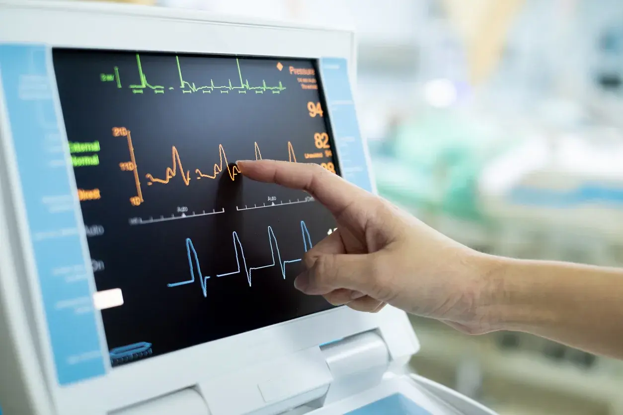 A vital signs monitor displaying real-time patient readings